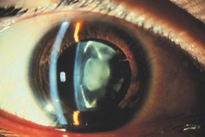 Finer Cut Glossary of Eyewear Terms